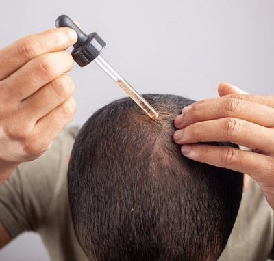 Topical and Oral Medication-Based Hair Regrowth Solutions Southampton