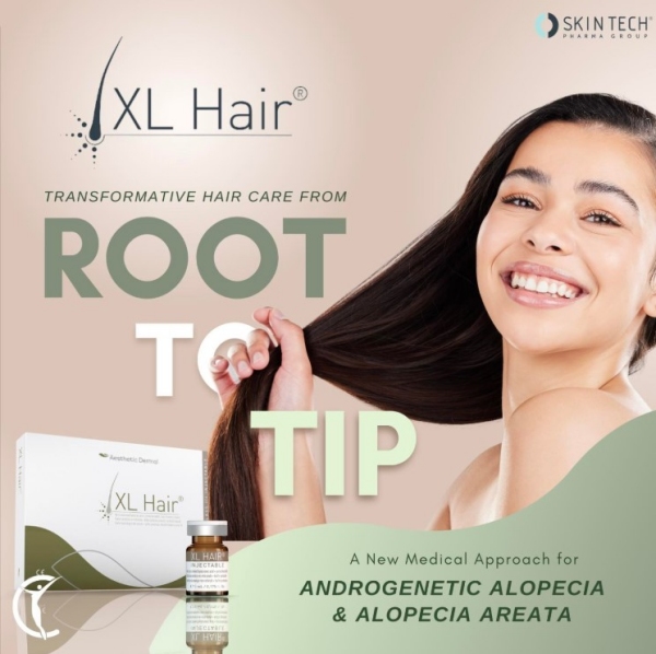 Mesotherapy with XL Hair Treatment for Hair Regrowth Southampton