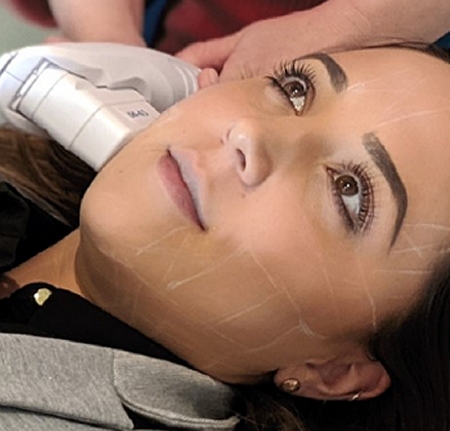 Non-Surgical Face and Neck Lifting With HIFU southampton